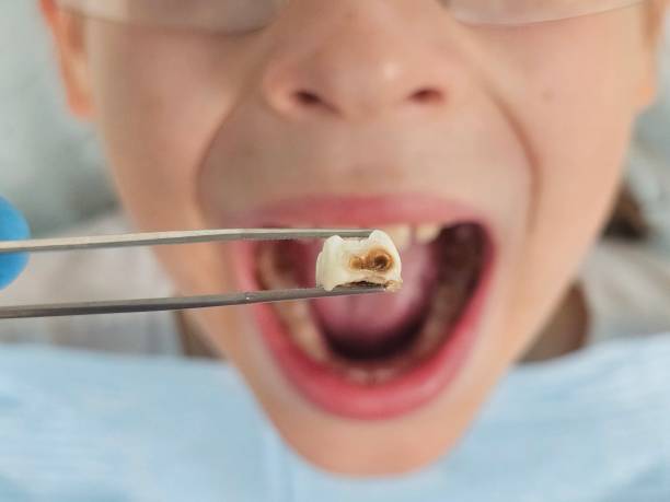 Best Broken Tooth Emergency  in Westmoreland, TN